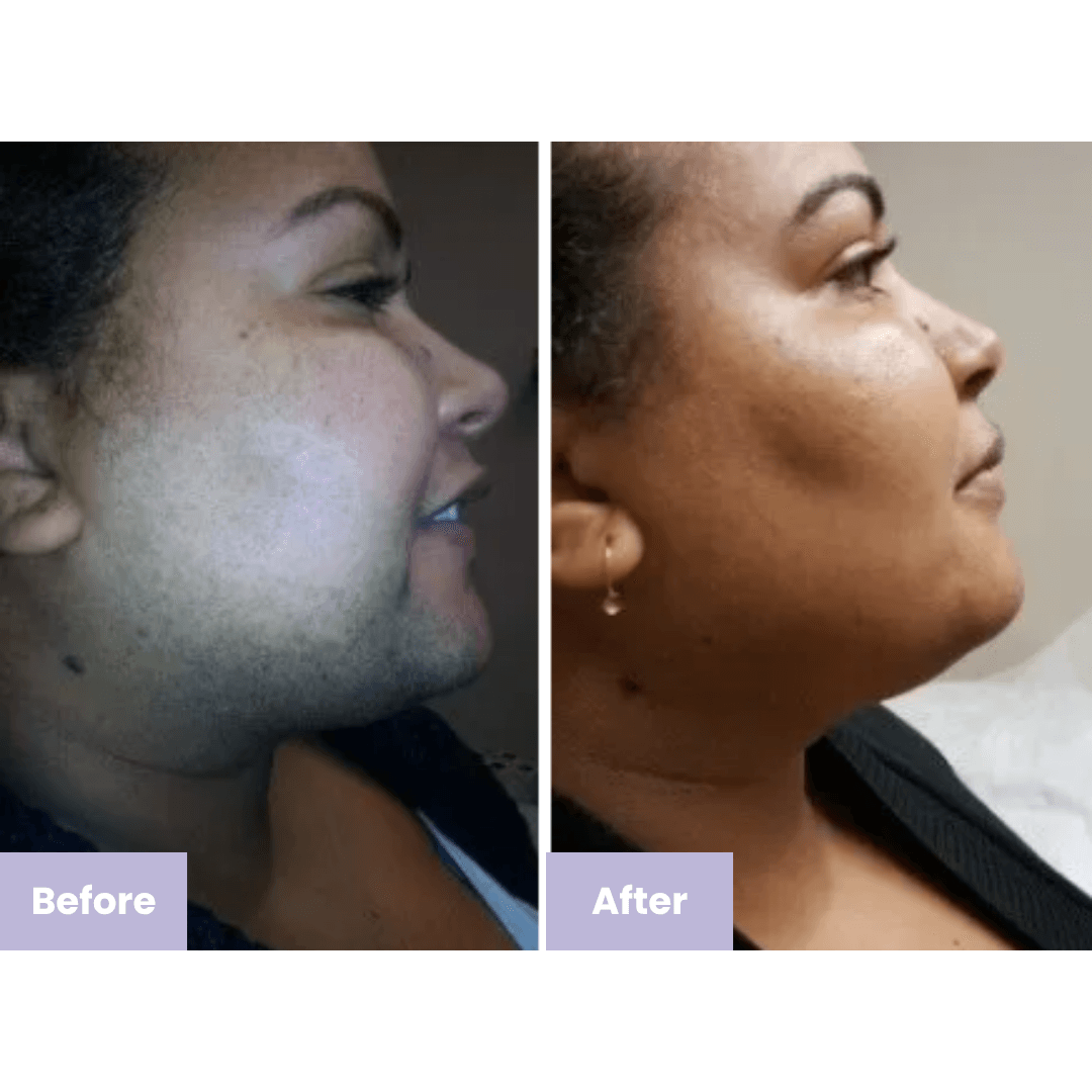 Instant Facial Hair Removing Cream