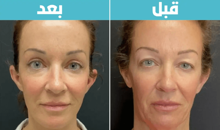 Anti-Aging Blue Copper Peptide Serum