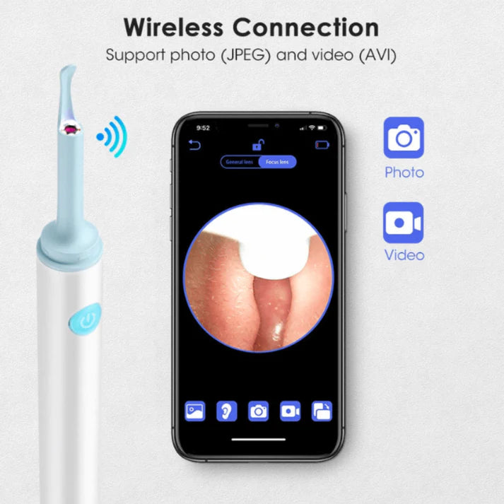 Ear Cleaner with Camera