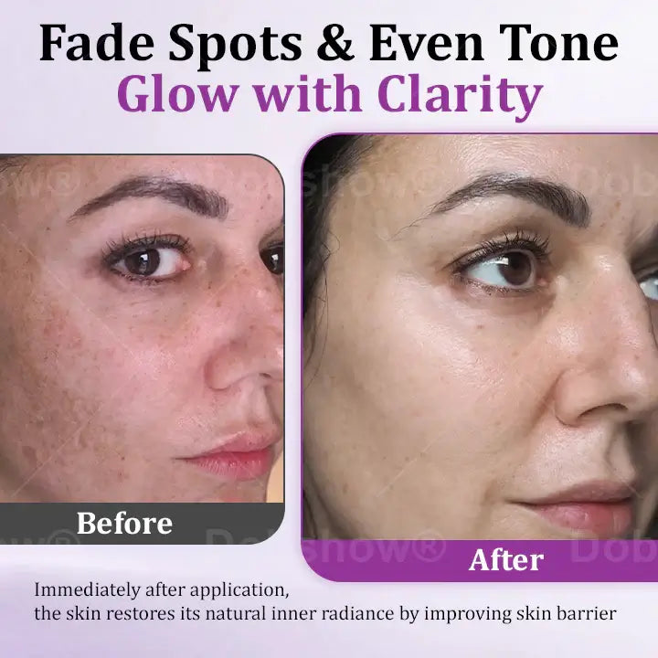 Melantrax Anti-Hyperpigmentation Essence