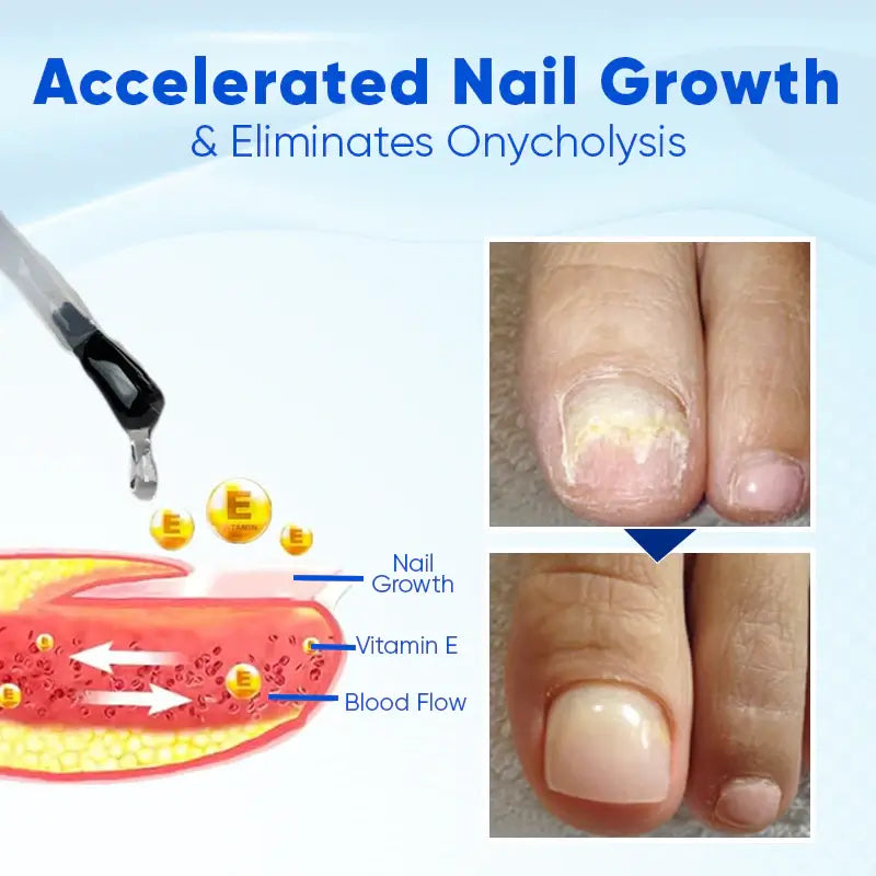 Nail Growth & Repair Serum