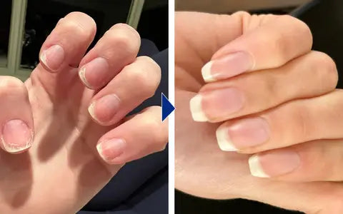 Nail Growth & Repair Serum