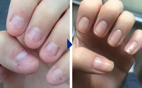 Nail Growth & Repair Serum