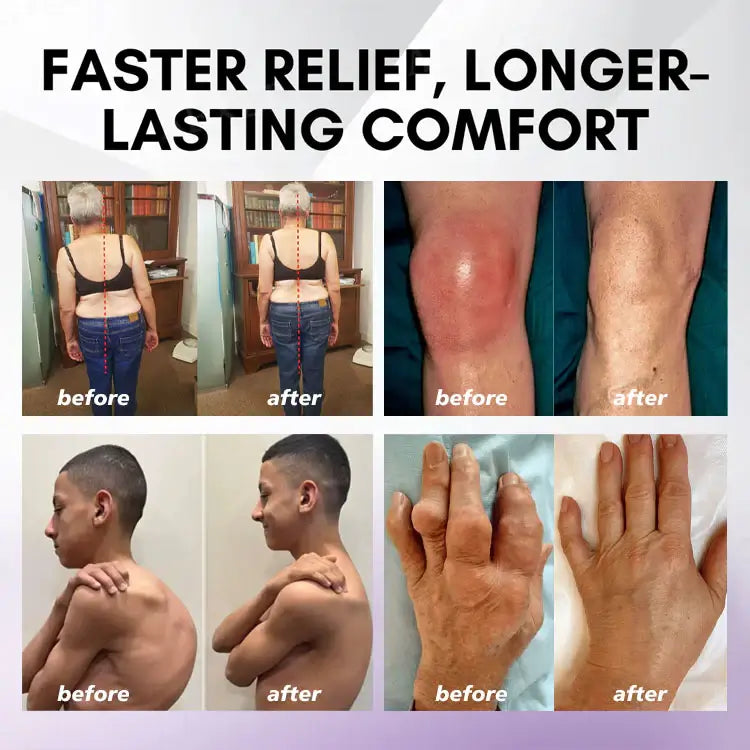 Turmeric & Emu Oil Pain Relief Gel