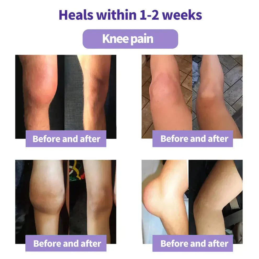 Turmeric & Emu Oil Pain Relief Gel