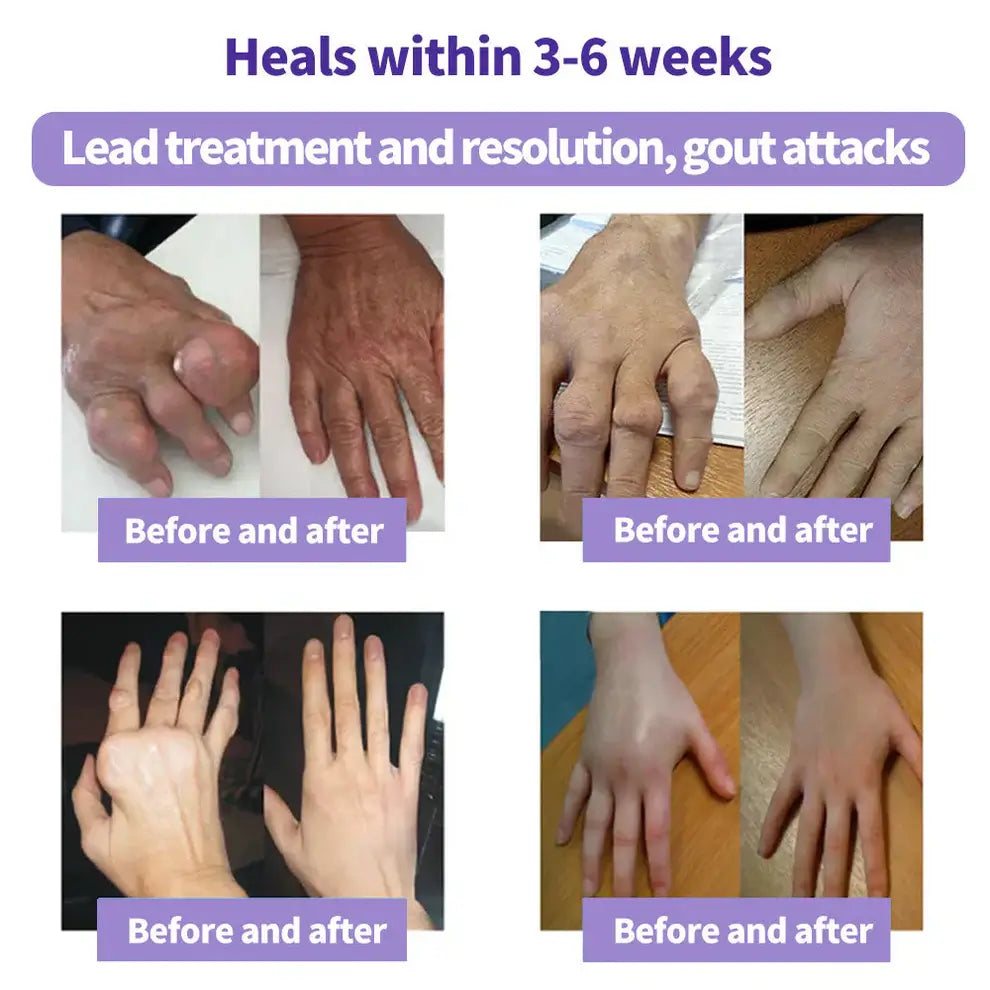 Turmeric & Emu Oil Pain Relief Gel