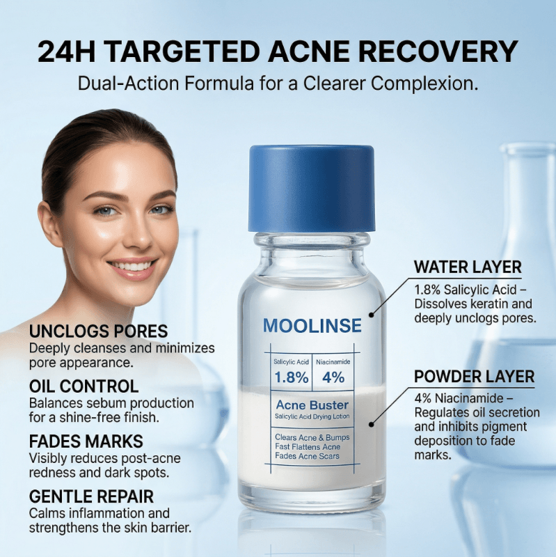 Pimple & Body Acne Treatment Lotion
