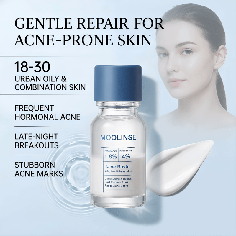 Pimple & Body Acne Treatment Lotion