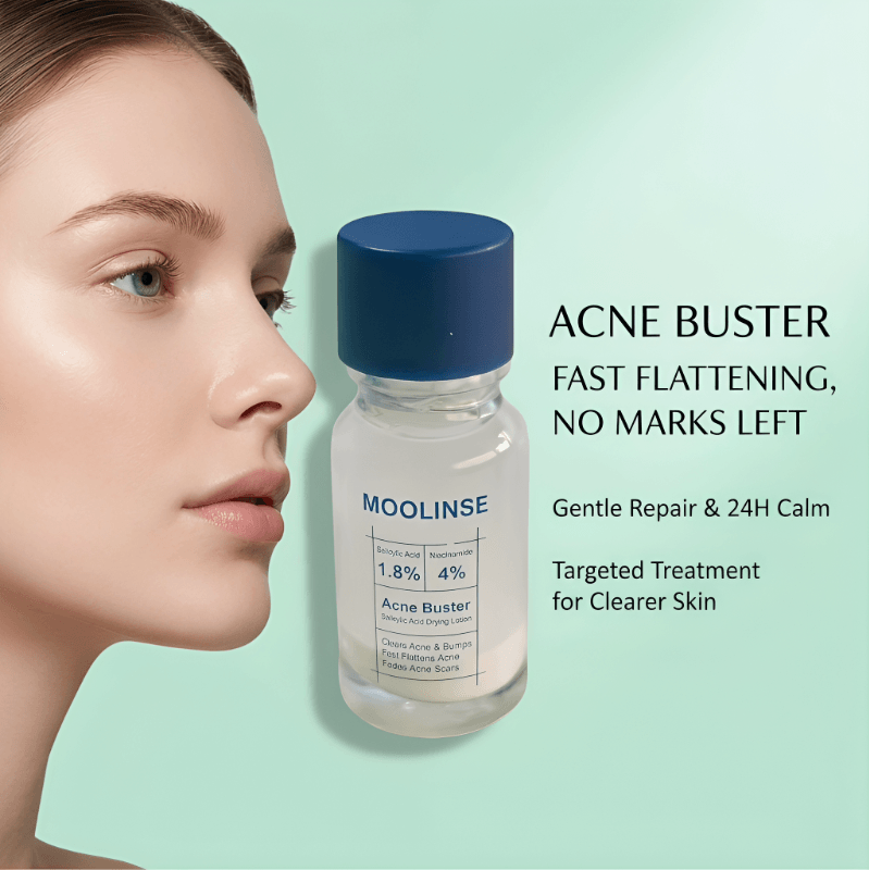 Pimple & Body Acne Treatment Lotion