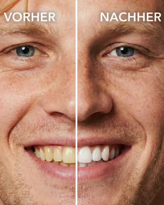 Teeth Polish - Instant Clean Smile