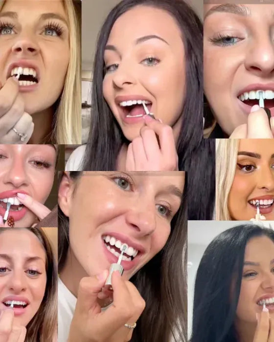 Teeth Polish - Instant Clean Smile