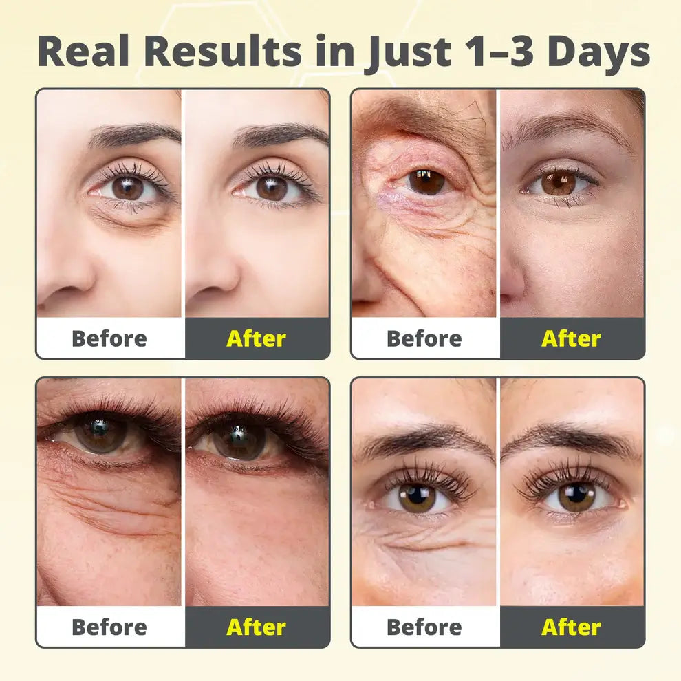 Vita A Retinal Tightening Serum