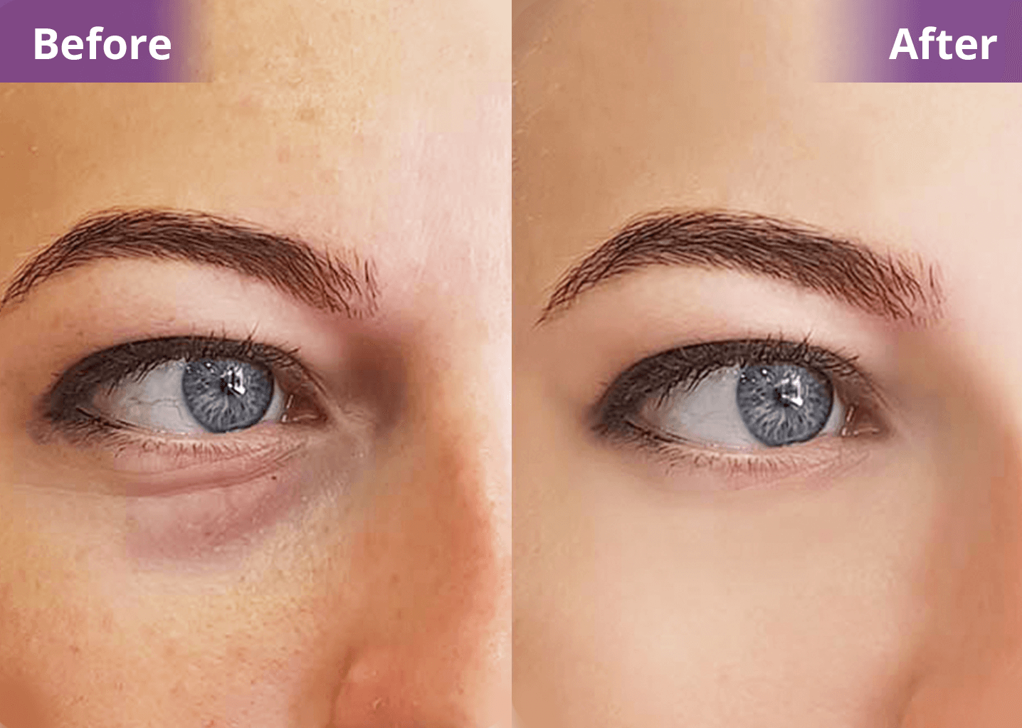 Vita A Retinal Tightening Serum