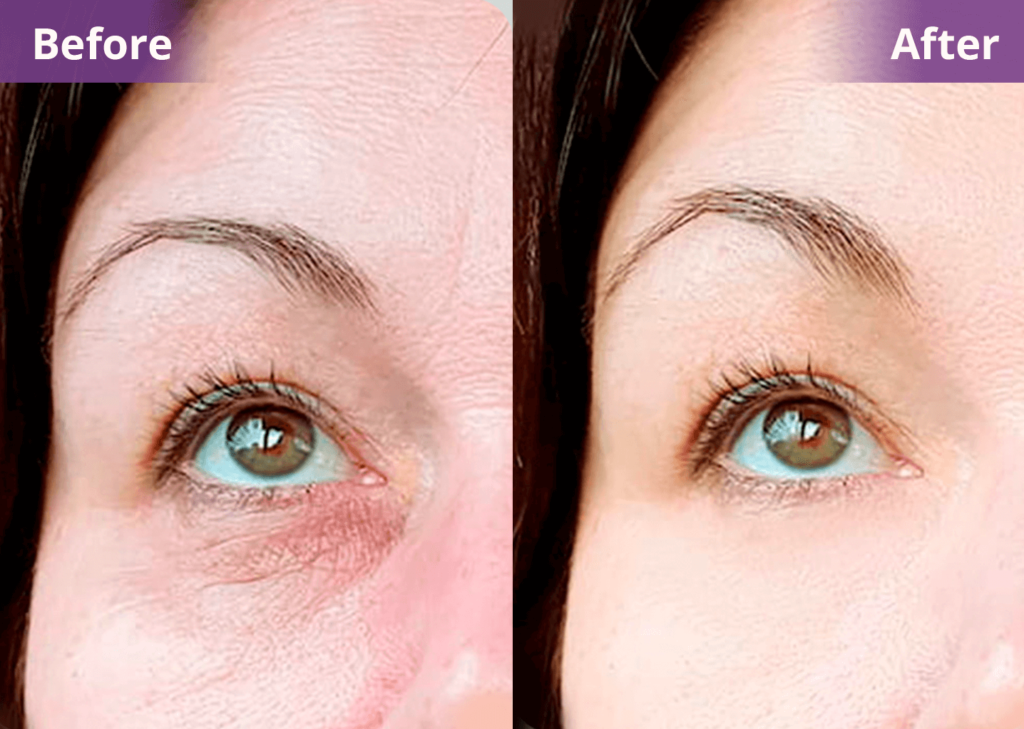 Vita A Retinal Tightening Serum